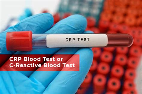 crp blood test bottle|crp blood test meaning uk.